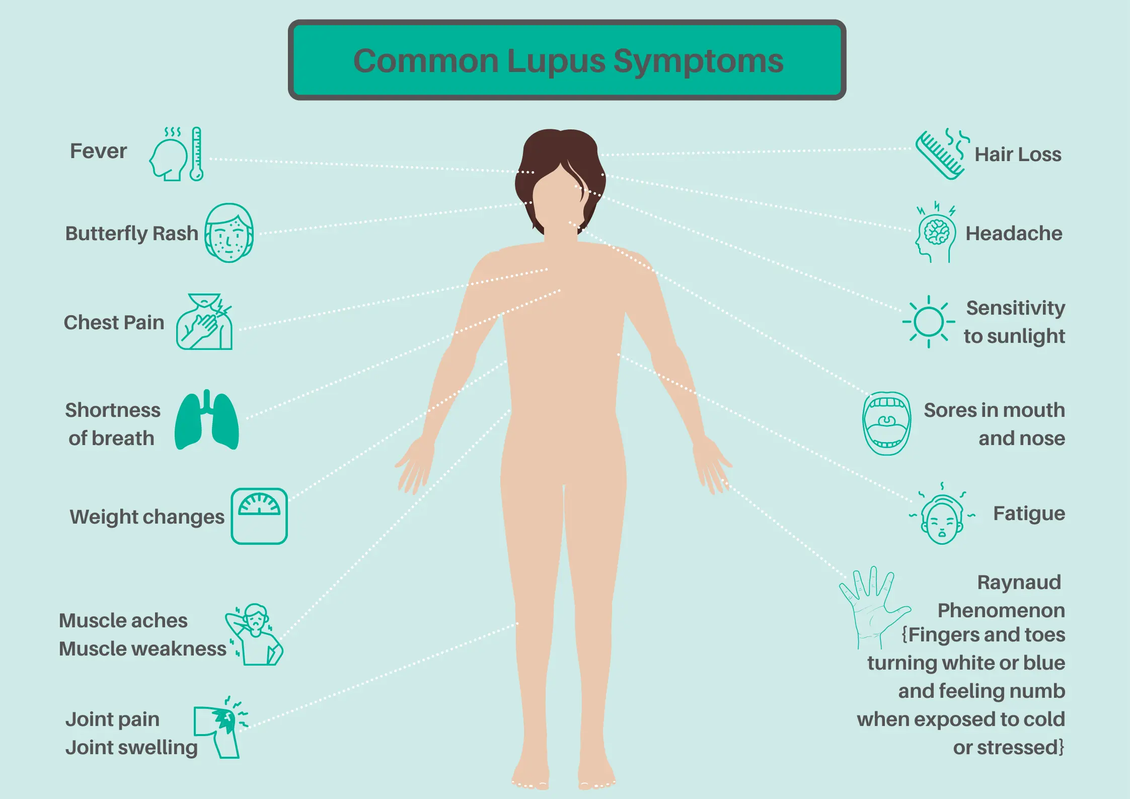 Common Lupus Symptoms