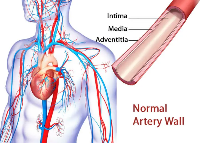 Normal Artery