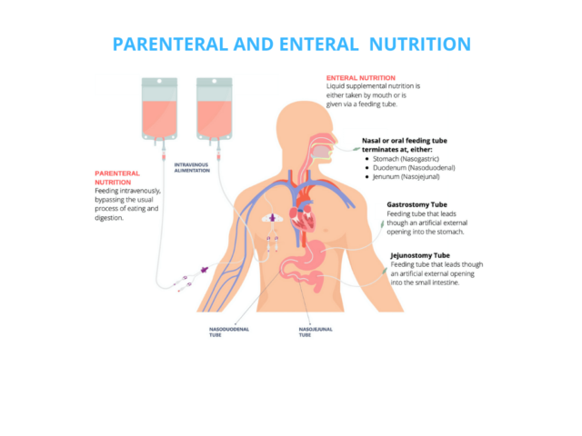 What Is Parenteral And Enteral Nutrition? - CredaHealth