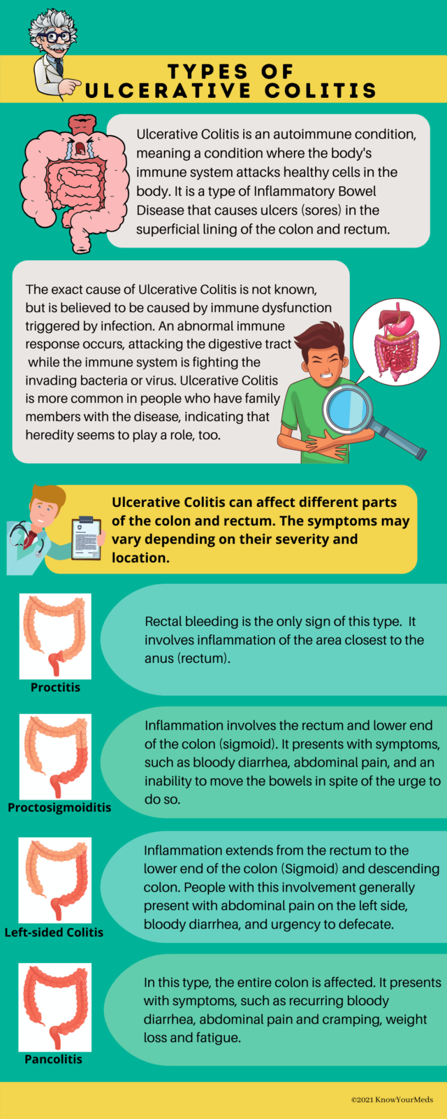 Different Types of Ulcerative Colitis (UC) and its symptoms - KnowYourMeds