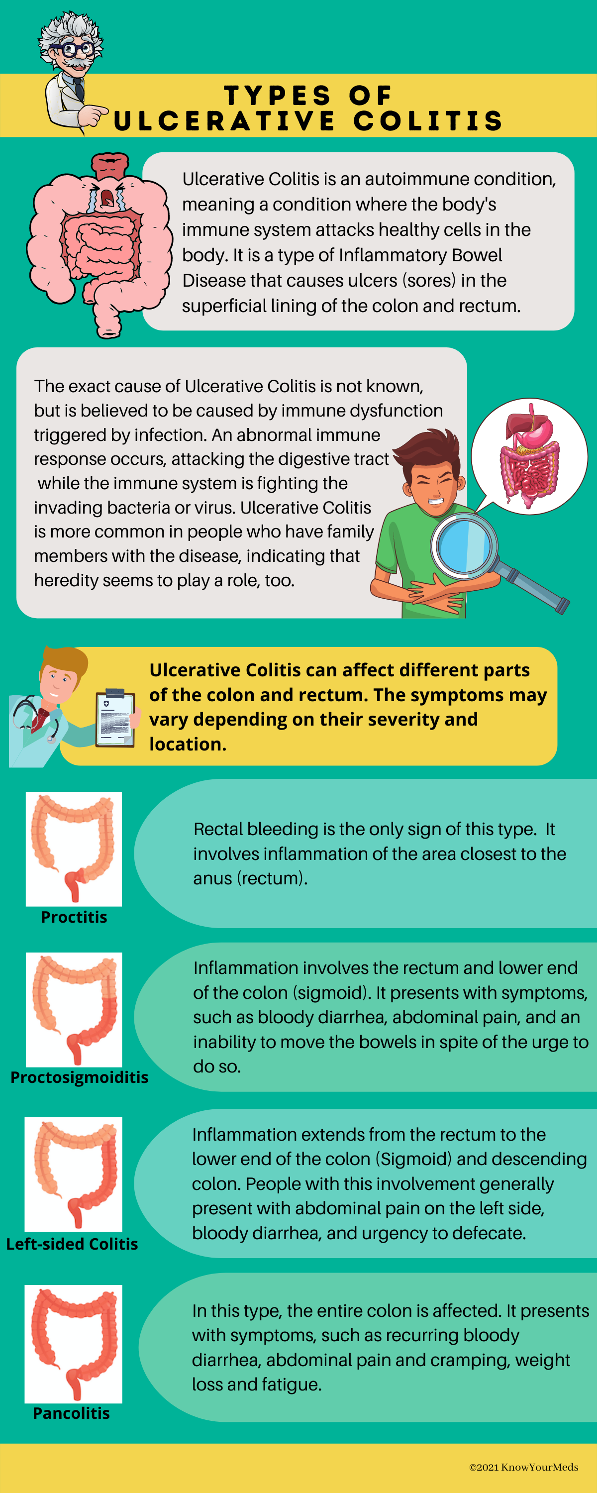 Types of ulcerative colitis